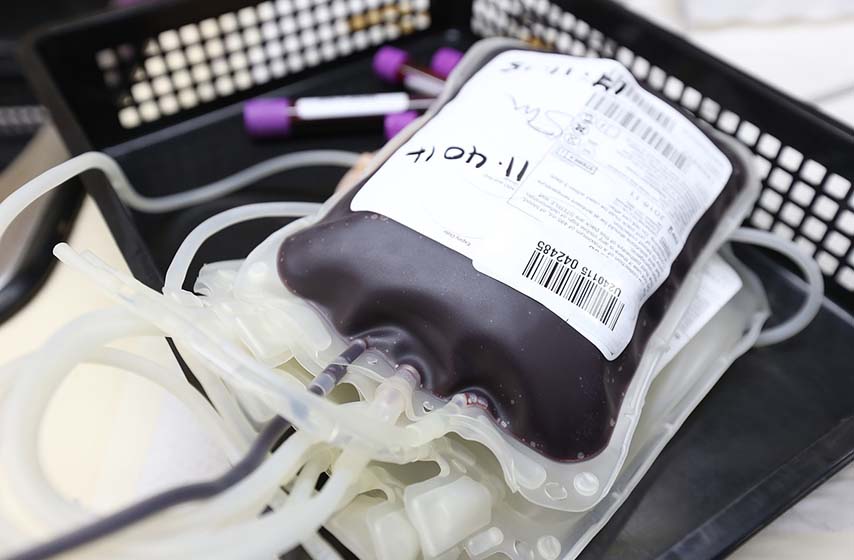 dobrovoljno davanje krvi, opovo, sefkerin